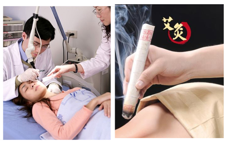 艾灸探花福利视频
